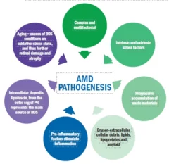 AMD pathogenesis