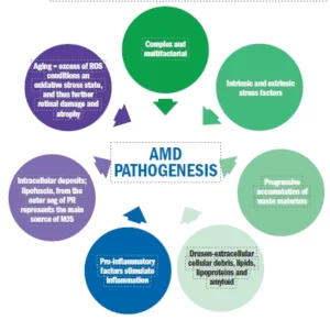 AMD pathogenesis