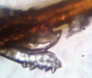 Demodex mite on an eyelash