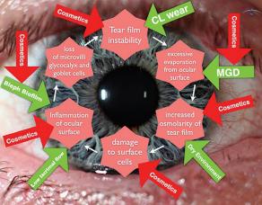 The vicious cycle of dry eye disease