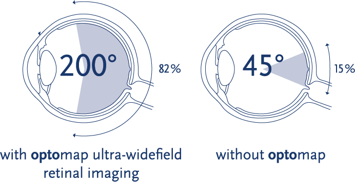 optomap angle 2